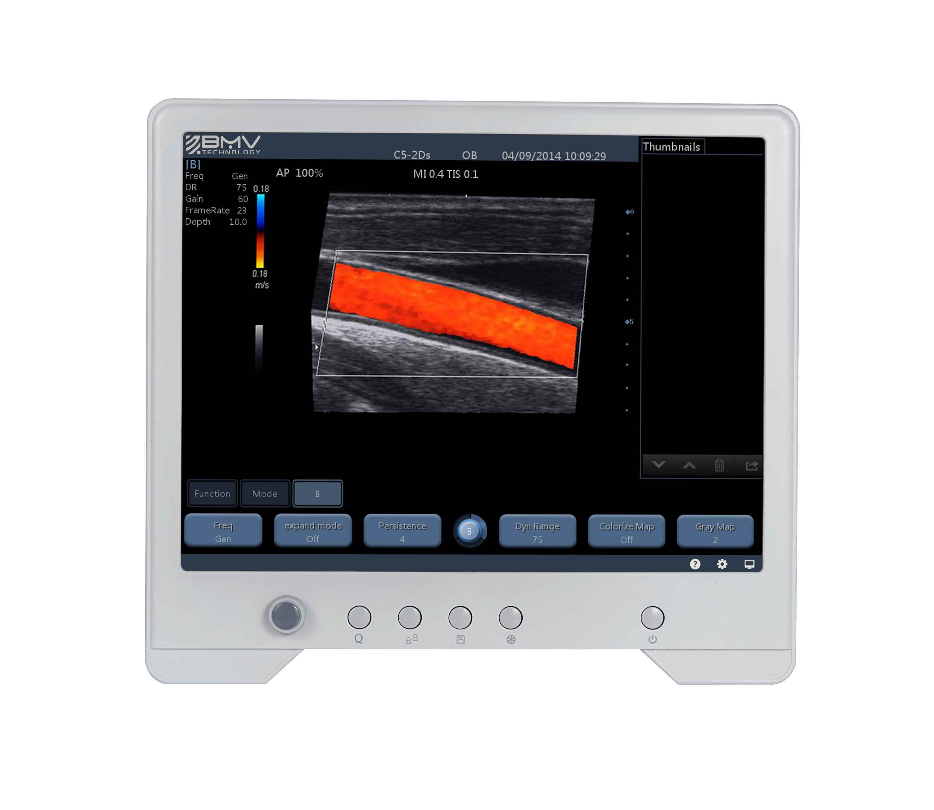 Touchscan 30 Imaging Diagnostic Equipment