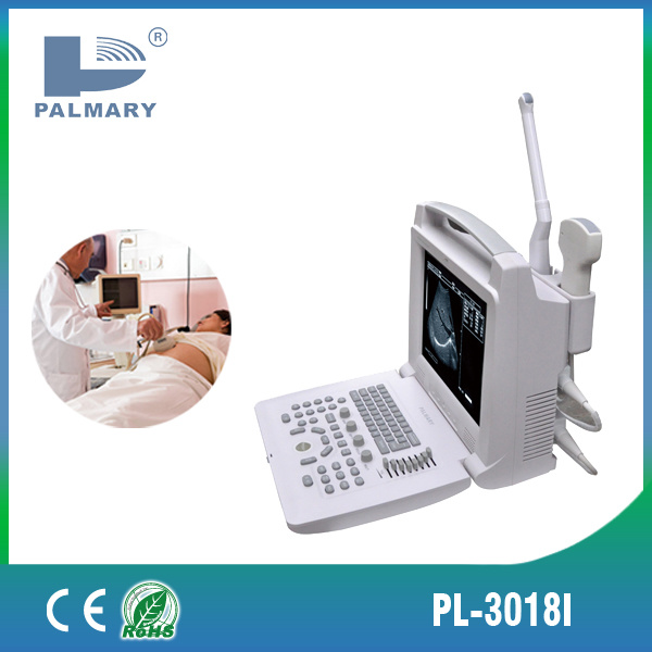Diagnostic Ultrasound Scanner Equipment