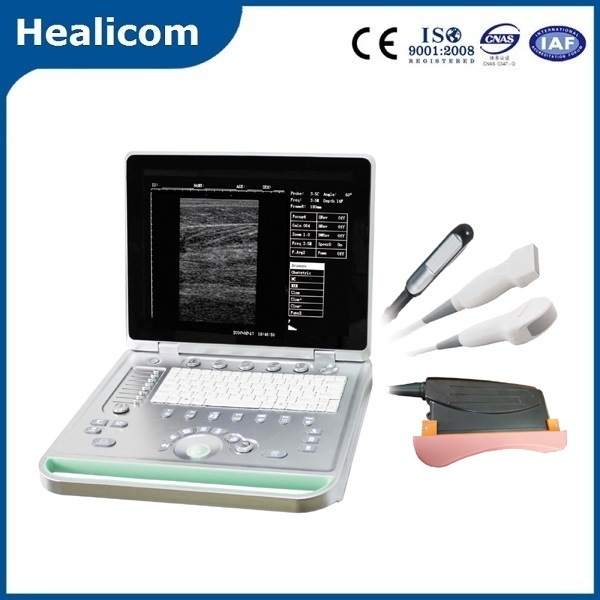 Hv7 Hot Sale Veterinary Laptop Ultrasound Scanner