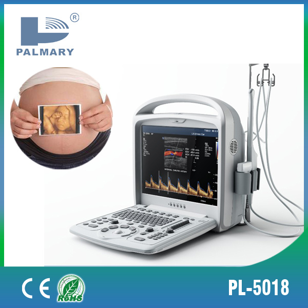 Portable Color Doppler with 3D Software