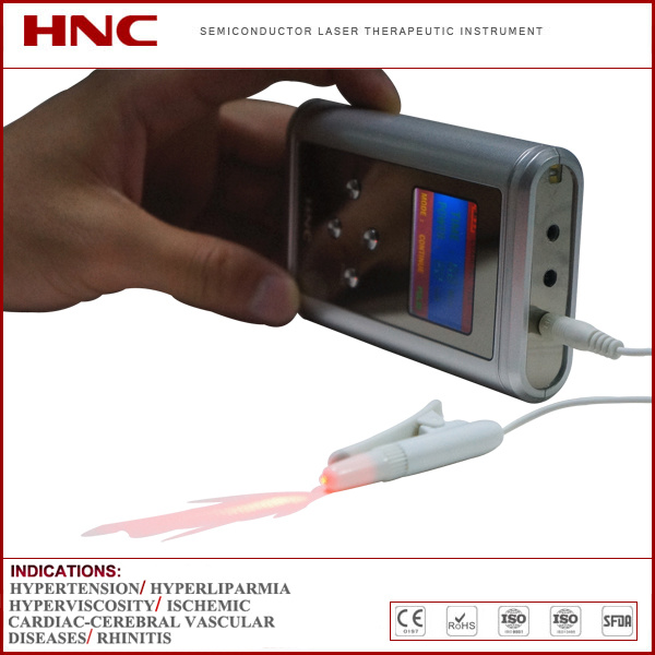 Hy05-a Allergic Rhinitis Treatment Laser Irradiation Physical Device