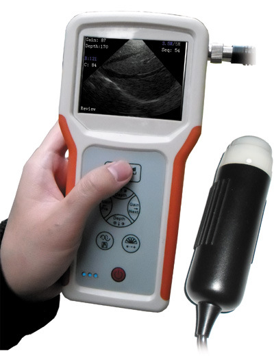 Handcarried Digital Ultrasound Scanner Diagnostic Equipment