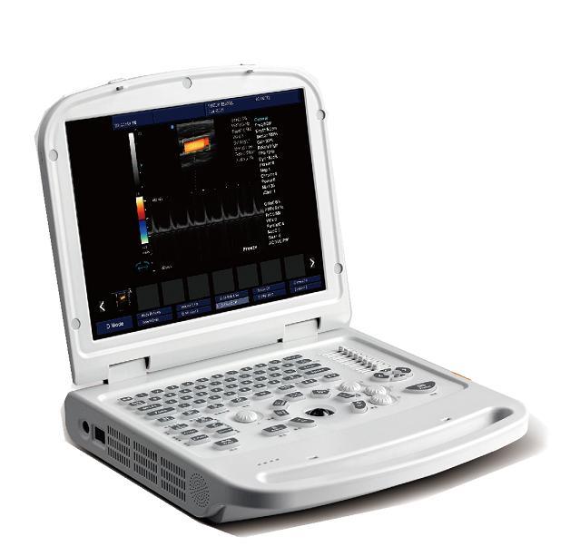 Color Doppler Ultrasound Scanner Medical Equipment