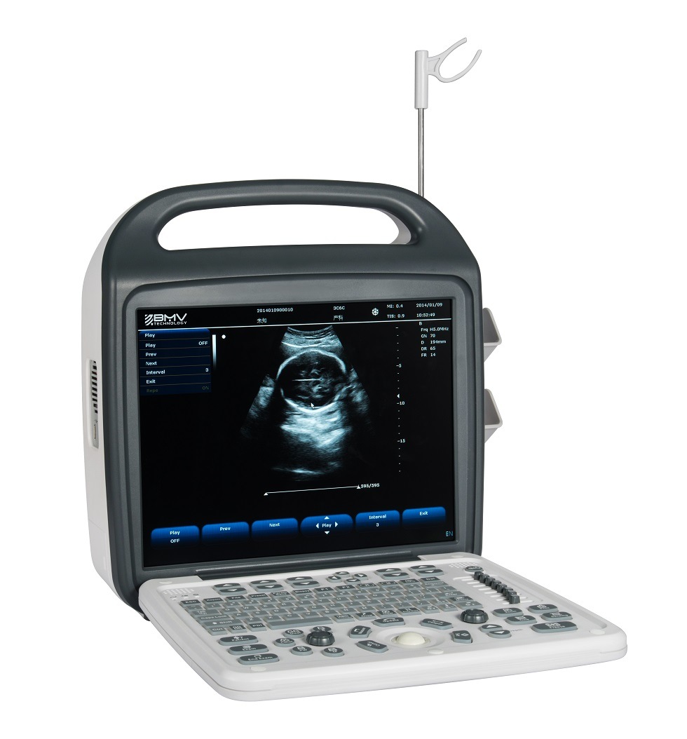 (BCU-30 PRO) Portable Color Doppler Ultrasound System