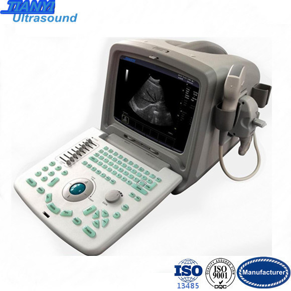 B&W Portable Ultrasound Scanner Medical Equipment (TY-6858A-1)