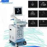 Medical Imaging Movable Color Doppler Ultrasound Equipment