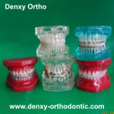 Dental Orthodontic Teeth Model