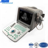 Portable Ultrasound Medical Equipment for Sale (TY-6858A-1)