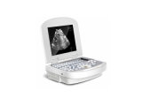 Medical Machine/Equipment for Hospital Laptop Ultrasound Scanner (RUS-2200)