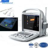 Portable Color Doppler Ultrasound Scanner Medical Equipment