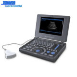 3D Full Digital Ultrasound Laptop Type Medical Equipment