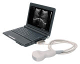 Mini Notebook Medical Ultrasound Equipment