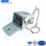 PC Based Ultrasound Scanner Medical Equipment