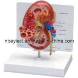 Medical Promotion Gift of 3D Anatomical Kidney Educating Model (EYAM-02)