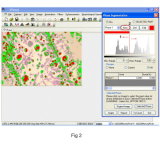 Metallurgical Microscope Analysis Metavision Software