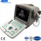 PC Based Portable Ultrasound Scanner Diagnosis Instrument