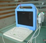 Hand-Hold Mini Laptop Ultrasound Equipment