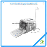 My-A002 All-Digital Portable Ultrasound Diagnosing Equipment