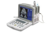 C12 Portable Digital Diagnostic Ultrasound Equipment