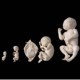 Fetus (Plastinated Specimen)