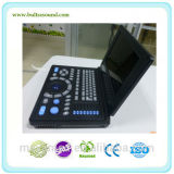 My-A008 PC System Laptop Ultrasound Equipment (10.4/12 inch screen)