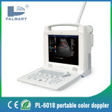 Portable Ultrasound Scanner Pl-6018 Color Doppler Medical Equipments