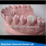 Dental Semi-Precious Alloy Pfm Inlay /Onlay Quality Dental Lab Supplies