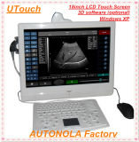 Medical Equipment - 18inch Touch Screen 3D Software Black and White Ultrasound Scanner Machine