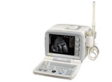 Full Digital B Mode Ultrasonic Diagnostic Instruments (Am-2000g)