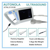 New Design Digital Palm Ultrasound Scanner (ATNL51353C)