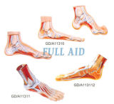 Normal, Flat, Arched Foot