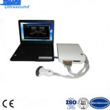 Portable Ultrasound Scanner Medical Equipment for Laptop