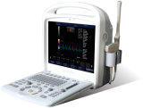 Advanced-Software Color Doppler Ultrasound Scanner