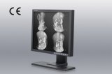 1MP 19-Inch 1280X1024 LCD Screen Monochrome Monitor, CE Approved, Angiography Equipment