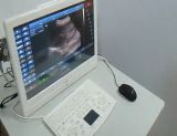 Touch Screen Ultrasound Scanner