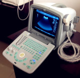 PC Based Echo Ultrasound Machine Medical Equipment