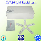 Meidical Supplies Coxsackie Virus 16 (CVA16) Rapid Test Reagent Clinical Lab Reagent