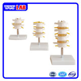 Wcy Lumbar Set Model