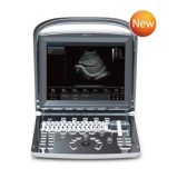 Medical Equipment Portable Digital Ultrasound Scanner