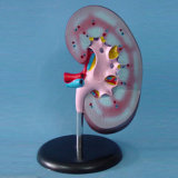Medical Teaching Kidney Anatomic Model (R110101)