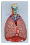 Larynx Heart and Lung Respiratory System Model