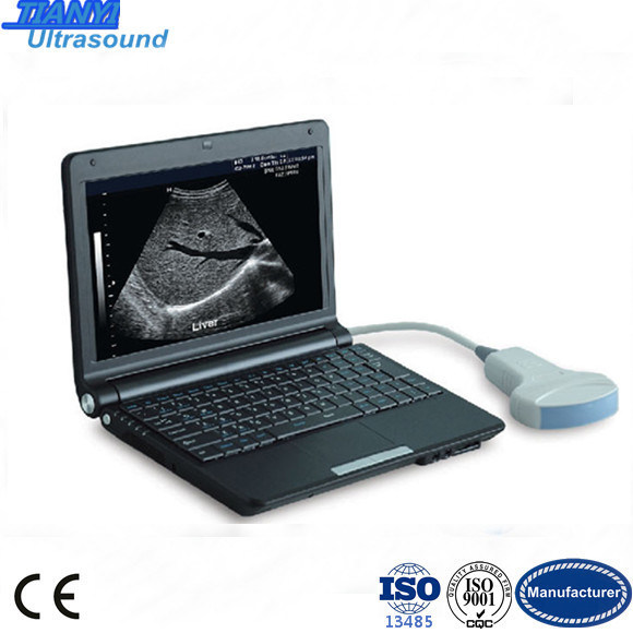 B Mode Laptop Ultrasound Scanner Diagnosis Equipment