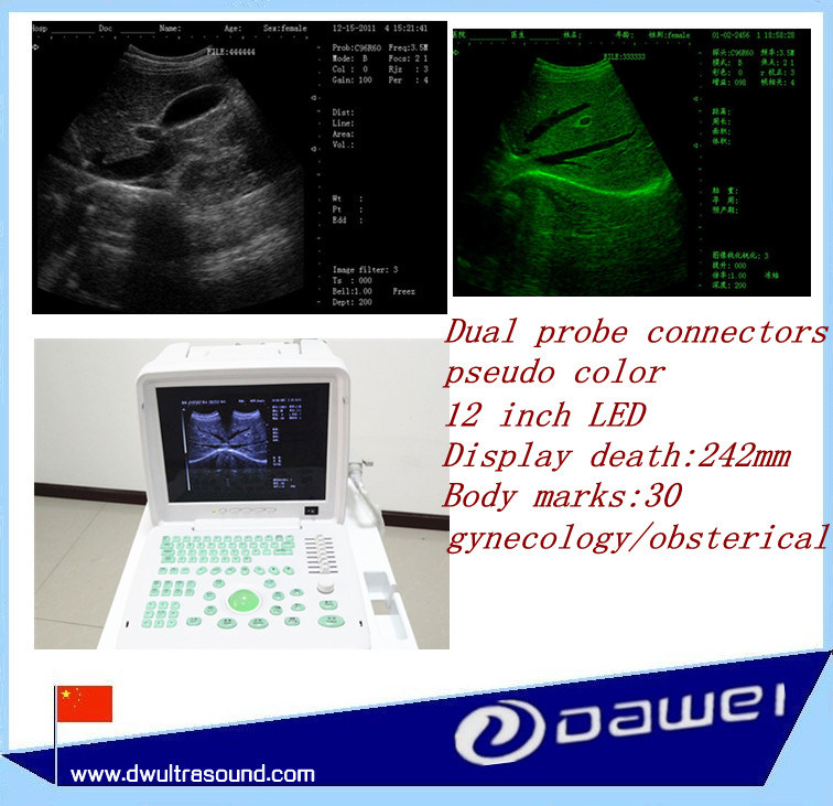 2d Diagnosis Ultrasound Equipment with Two Probe Interfaces