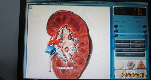 Factory Price Portable 3D Nls / 3D- Full Body Health Analyzer