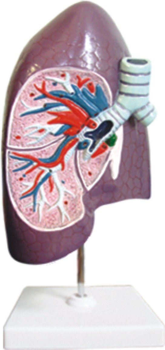 Dissection Model of Bronchus in Right Lung-Mh07031.01