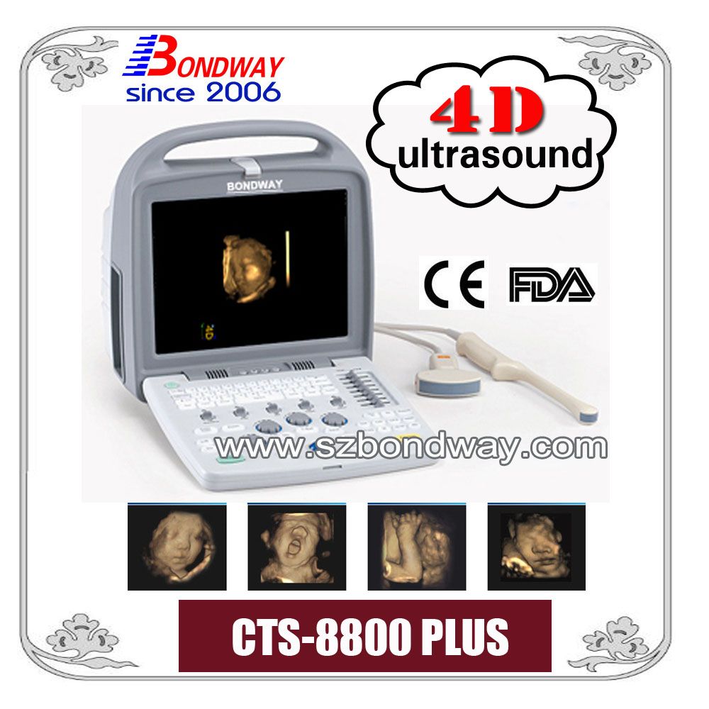 4D Ultrasound Imaging System Obstetrics, Gynecology, Tissue Harmonic Imaging, Compound Imaging, 4D Transducer, Volumetric Probe