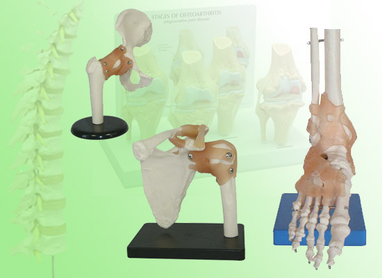 Joint Models