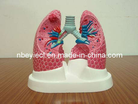 Medical Promotion Gift of 3D Anatomical Lung Model (EYAM-01)