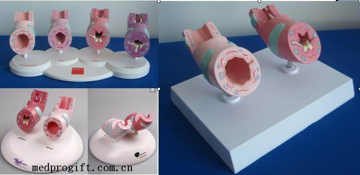 Bronchial Models