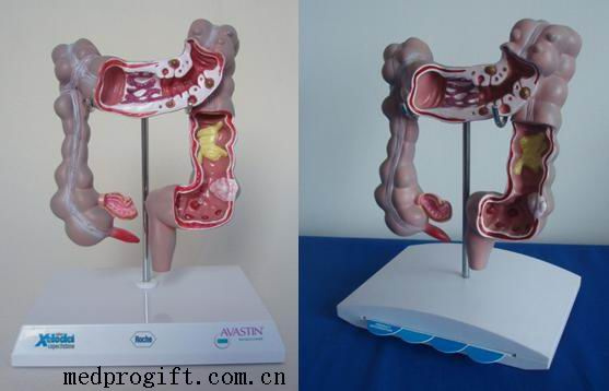 Colon Models